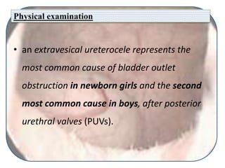 Physical examination
• an extravesical ureterocele represents the
most common cause of bladder outlet
obstruction in newborn girls and the second
most common cause in boys, after posterior
urethral valves (PUVs).
 