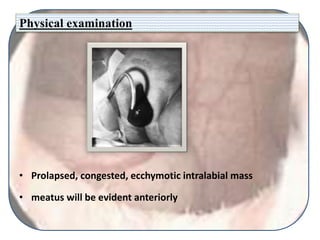 Physical examination
• Prolapsed, congested, ecchymotic intralabial mass
• meatus will be evident anteriorly
 