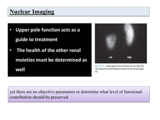 Nuclear Imaging
• Upper pole function acts as a
guide to treatment
• The health of the other renal
moieties must be determined as
well
yet there are no objective parameters to determine what level of functional
contribution should be preserved
 