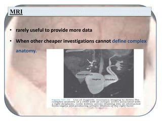 MRI
• rarely useful to provide more data
• When other cheaper investigations cannot define complex
anatomy.
 