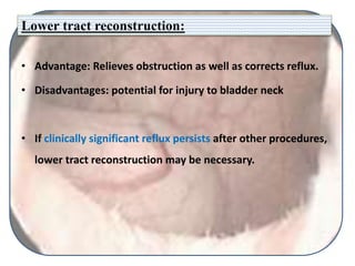 Lower tract reconstruction:
• Advantage: Relieves obstruction as well as corrects reflux.
• Disadvantages: potential for injury to bladder neck
• If clinically significant reflux persists after other procedures,
lower tract reconstruction may be necessary.
 