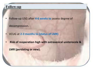 Follow-up
• Follow-up USG after 4-6 weeks to assess degree of
decompression.
• VCUG at 2-3 months to (status of LMR)
• Risk of reoperation high with extravesical ureterocele &
LMR (persisting or new).
 