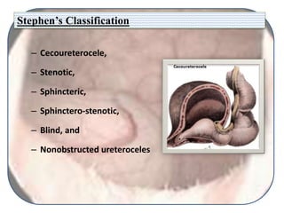 Stephen’s Classification
– Cecoureterocele,
– Stenotic,
– Sphincteric,
– Sphinctero-stenotic,
– Blind, and
– Nonobstructed ureteroceles
 