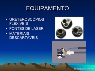 EQUIPAMENTO URETEROSCÓPIOS FLEXIVEIS FONTES DE LASER MATERIAIS DESCARTÁVEIS DR AUGUSTO XAVIER 