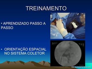 TREINAMENTO ORIENTAÇÃO ESPACIAL NO SISTEMA COLETOR APRENDIZADO PASSO A PASSO DR AUGUSTO XAVIER 