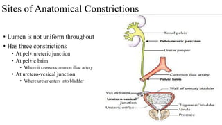 Sites of Anatomical Constrictions
• Lumen is not uniform throughout
• Has three constrictions
• At pelviureteric junction
• At pelvic brim
• Where it crosses common iliac artery
• At uretero-vesical junction
• Where ureter enters into bladder
 