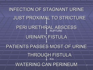 2828
INFECTION OF STAGNANT URINEINFECTION OF STAGNANT URINE
JUST PROXIMAL TO STRICTUREJUST PROXIMAL TO STRICTURE
PERI URETHRAL ABSCESSPERI URETHRAL ABSCESS
URINARY FISTULAURINARY FISTULA
PATIENTS PASSES MOST OF URINEPATIENTS PASSES MOST OF URINE
THROUGH FISTULATHROUGH FISTULA
WATERING CAN PERINEUMWATERING CAN PERINEUM
RUPTURE
K/a
 