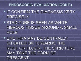 4343
ENDOSCOPIC EVALUATION (CONT.)ENDOSCOPIC EVALUATION (CONT.)
 IT CONFIRM THE DIAGNOSIS VERYIT CONFIRM THE DIAGNOSIS VERY
PRECISELYPRECISELY
 STRICTURE IS SEEN AS WHITESTRICTURE IS SEEN AS WHITE
FIBROUS TISSUE AROUND A SMALLFIBROUS TISSUE AROUND A SMALL
HOLEHOLE
 URETHRA MAY BE CENTRALLYURETHRA MAY BE CENTRALLY
SITUATED OR TOWARDS THESITUATED OR TOWARDS THE
ROOF OR FLOOR. THE STRICTUREROOF OR FLOOR. THE STRICTURE
MAY TAKE THE FORM OFMAY TAKE THE FORM OF
CRESCENT.CRESCENT.
 