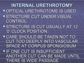 5656
INTERNAL URETHROTOMYINTERNAL URETHROTOMY
 OPTICAL URETHROTOME IS USEDOPTICAL URETHROTOME IS USED
 STRICTURE CUT UNDER VISUALSTRICTURE CUT UNDER VISUAL
CONTROL.CONTROL.
 STRICTURE IS CUT USUALLY AT 12STRICTURE IS CUT USUALLY AT 12
‘0’ CLOCK POSITION.‘0’ CLOCK POSITION.
 CARE SHOULD BE TAKEN NOT TOCARE SHOULD BE TAKEN NOT TO
CUT TOO DEEPLY INTO VASCULARCUT TOO DEEPLY INTO VASCULAR
SPACE AT CORPUS SPONGIOSUMSPACE AT CORPUS SPONGIOSUM
 IF ONE CUT IS INSUFFICIENTIF ONE CUT IS INSUFFICIENT
ANOTHER CUT CAN BE MADE UNTILANOTHER CUT CAN BE MADE UNTIL
THERE IS WIDE PASSAGETHERE IS WIDE PASSAGE
 