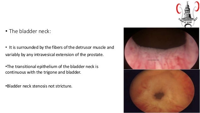 Urethral Anatomy Male