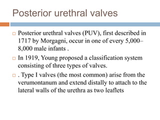 Posterior urethral valves
 Posterior urethral valves (PUV), first described in
1717 by Morgagni, occur in one of every 5,000–
8,000 male infants .
 In 1919, Young proposed a classification system
consisting of three types of valves.
 . Type I valves (the most common) arise from the
verumontanum and extend distally to attach to the
lateral walls of the urethra as two leaflets
 