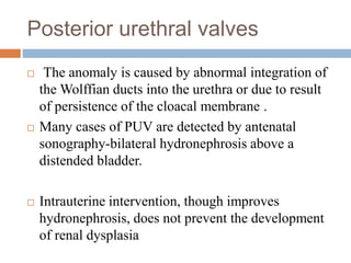 Posterior urethral valves
 The anomaly is caused by abnormal integration of
the Wolffian ducts into the urethra or due to result
of persistence of the cloacal membrane .
 Many cases of PUV are detected by antenatal
sonography-bilateral hydronephrosis above a
distended bladder.
 Intrauterine intervention, though improves
hydronephrosis, does not prevent the development
of renal dysplasia
 