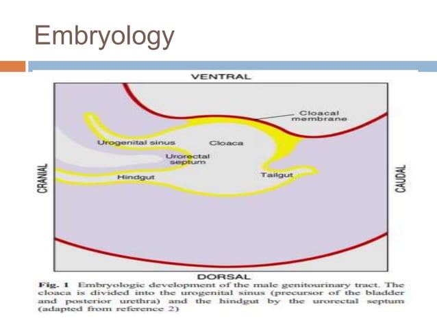Urethral anomalies | PPTX