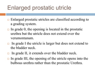 Enlarged prostatic utricle
 Enlarged prostatic utricles are classified according to
a grading system.
 In grade 0, the opening is located in the prostatic
urethra but the utricle does not extend over the
verumontanum.
 In grade I the utricle is larger but does not extend to
the bladder neck.
 In grade II, it extends over the bladder neck.
 In grade III, the opening of the utricle opens into the
bulbous urethra rather than the prostatic Urethra.
 
