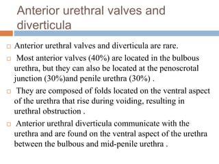 Anterior urethral valves and
diverticula
 Anterior urethral valves and diverticula are rare.
 Most anterior valves (40%) are located in the bulbous
urethra, but they can also be located at the penoscrotal
junction (30%)and penile urethra (30%) .
 They are composed of folds located on the ventral aspect
of the urethra that rise during voiding, resulting in
urethral obstruction .
 Anterior urethral diverticula communicate with the
urethra and are found on the ventral aspect of the urethra
between the bulbous and mid-penile urethra .
 