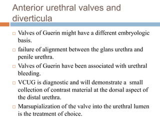Anterior urethral valves and
diverticula
 Valves of Guerin might have a different embryologic
basis.
 failure of alignment between the glans urethra and
penile urethra.
 Valves of Guerin have been associated with urethral
bleeding.
 VCUG is diagnostic and will demonstrate a small
collection of contrast material at the dorsal aspect of
the distal urethra.
 Marsupialization of the valve into the urethral lumen
is the treatment of choice.
 