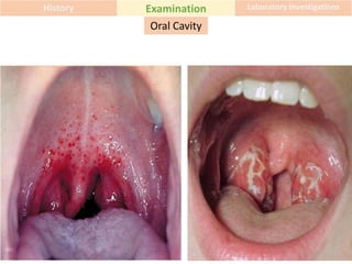 History Examination Laboratory Investigations
Oral Cavity
 