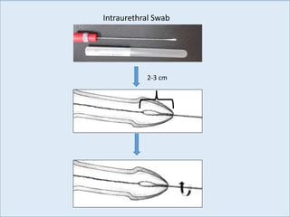 Intraurethral Swab
2-3 cm
 