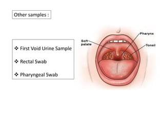 Other samples :
 First Void Urine Sample
 Rectal Swab
 Pharyngeal Swab
 