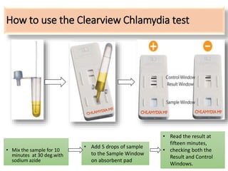 How to use the Clearview Chlamydia test
• Mix the sample for 10
minutes at 30 deg.with
sodium azide
• Add 5 drops of sample
to the Sample Window
on absorbent pad
• Read the result at
fifteen minutes,
• checking both the
Result and Control
Windows.
 
