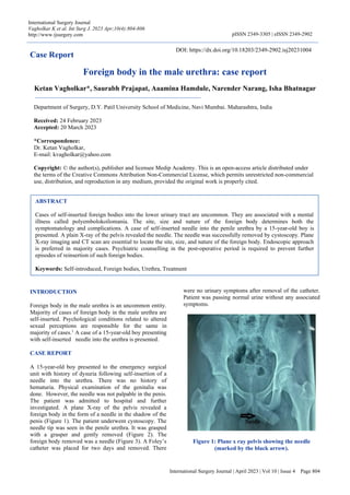 International Surgery Journal | April 2023 | Vol 10 | Issue 4 Page 804
International Surgery Journal
Vagholkar K et al. Int Surg J. 2023 Apr;10(4):804-806
http://www.ijsurgery.com pISSN 2349-3305 | eISSN 2349-2902
Case Report
Foreign body in the male urethra: case report
Ketan Vagholkar*, Saurabh Prajapat, Aaamina Hamdule, Narender Narang, Isha Bhatnagar
INTRODUCTION
Foreign body in the male urethra is an uncommon entity.
Majority of cases of foreign body in the male urethra are
self-inserted. Psychological conditions related to altered
sexual perceptions are responsible for the same in
majority of cases.1
A case of a 15-year-old boy presenting
with self-inserted needle into the urethra is presented.
CASE REPORT
A 15-year-old boy presented to the emergency surgical
unit with history of dysuria following self-insertion of a
needle into the urethra. There was no history of
hematuria. Physical examination of the genitalia was
done. However, the needle was not palpable in the penis.
The patient was admitted to hospital and further
investigated. A plane X-ray of the pelvis revealed a
foreign body in the form of a needle in the shadow of the
penis (Figure 1). The patient underwent cystoscopy. The
needle tip was seen in the penile urethra. It was grasped
with a grasper and gently removed (Figure 2). The
foreign body removed was a needle (Figure 3). A Foley’s
catheter was placed for two days and removed. There
were no urinary symptoms after removal of the catheter.
Patient was passing normal urine without any associated
symptoms.
Figure 1: Plane x ray pelvis showing the needle
(marked by the black arrow).
ABSTRACT
Cases of self-inserted foreign bodies into the lower urinary tract are uncommon. They are associated with a mental
illness called polyembolokoilomania. The site, size and nature of the foreign body determines both the
symptomatology and complications. A case of self-inserted needle into the penile urethra by a 15-year-old boy is
presented. A plain X-ray of the pelvis revealed the needle. The needle was successfully removed by cystoscopy. Plane
X-ray imaging and CT scan are essential to locate the site, size, and nature of the foreign body. Endoscopic approach
is preferred in majority cases. Psychiatric counselling in the post-operative period is required to prevent further
episodes of reinsertion of such foreign bodies.
Keywords: Self-introduced, Foreign bodies, Urethra, Treatment
Department of Surgery, D.Y. Patil University School of Medicine, Navi Mumbai. Maharashtra, India
Received: 24 February 2023
Accepted: 20 March 2023
*Correspondence:
Dr. Ketan Vagholkar,
E-mail: kvagholkar@yahoo.com
Copyright: © the author(s), publisher and licensee Medip Academy. This is an open-access article distributed under
the terms of the Creative Commons Attribution Non-Commercial License, which permits unrestricted non-commercial
use, distribution, and reproduction in any medium, provided the original work is properly cited.
DOI: https://dx.doi.org/10.18203/2349-2902.isj20231004
 