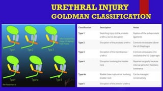 URETHRAL INJURY- Trauma Surgery