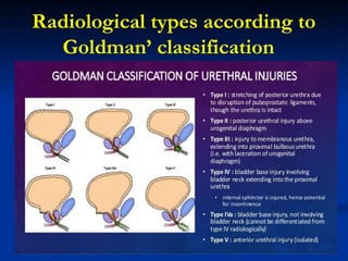Urethral injuries: anatomical consideration and initial management by ...