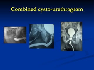 Cystourethrogram Technique Urethral injuries: anatomical consideration and initial management by ...