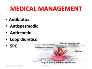 MEDICAL MANAGEMENT
• Antibiotics
• Antispasmodic
• Antiemetic
• Loop diuretics
• SPC
Friday, December 18, 2020 MOUNESH 14
 