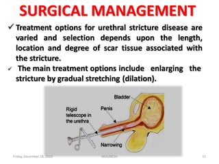 SURGICAL MANAGEMENT
 Treatment options for urethral stricture disease are
varied and selection depends upon the length,
location and degree of scar tissue associated with
the stricture.
 The main treatment options include enlarging the
stricture by gradual stretching (dilation).
Friday, December 18, 2020 15MOUNESH
 