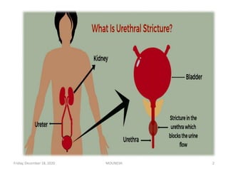 Friday, December 18, 2020 MOUNESH 2
 