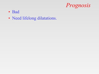 Prognosis
• Bad
• Need lifelong dilatations.
 