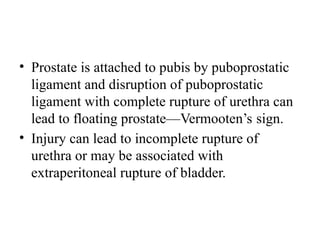 • Prostate is attached to pubis by puboprostatic
ligament and disruption of puboprostatic
ligament with complete rupture of urethra can
lead to floating prostate—Vermooten’s sign.
• Injury can lead to incomplete rupture of
urethra or may be associated with
extraperitoneal rupture of bladder.
 