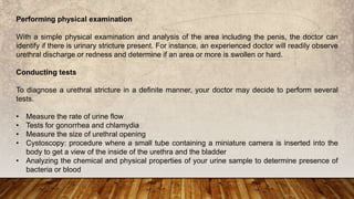 Urethral Stricture Causes, Risk Factors, And Diagnosis | PPTX