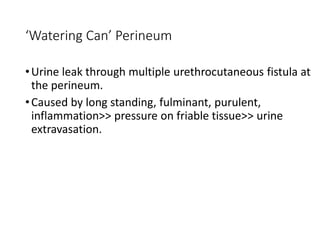 ‘Watering Can’ Perineum
•Urine leak through multiple urethrocutaneous fistula at
the perineum.
•Caused by long standing, fulminant, purulent,
inflammation>> pressure on friable tissue>> urine
extravasation.
 