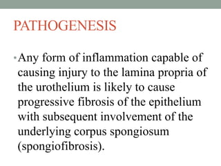 PATHOGENESIS
•Any form of inflammation capable of
causing injury to the lamina propria of
the urothelium is likely to cause
progressive fibrosis of the epithelium
with subsequent involvement of the
underlying corpus spongiosum
(spongiofibrosis).
 