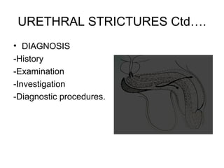 Urethral strictures | PPT