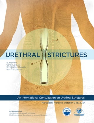 An International Consultation on Urethral Strictures
Marrakech, Morocco, October 13-16, 2010
Co-sponsored by
SIU (Société Internationale d’Urologie)
ICUD (International Consultation on Urological Diseases)
EDITED BY:
Gerald Jordan,
Christopher Chapple
and Chris Heyns
Strictures
Urethral
 