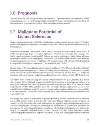 99
Anterior Urethra – Lichen Sclerosus
5.6 Prognosis
Can early detection and consequent medical treatment of LS prevent urethral involvement? A recent
epidemiological study in the UK suggests that early detection and treatment may prevent the devel-
opment of severe symptoms and possibly allow patients to avoid surgery (15).
5.7	
Malignant Potential of
Lichen Sclerosus
The pre-malignant potential of LS of the vulva has been well recognized for some time (19). But the
potential development of squamous carcinoma in men with LS affecting the penis has until recently
been less clear.
The association between LS and penile cancer varies. A review of 20 cases of penile cancer found LS
on the same pathology slides as cancer in eight cases (40%). Review of the case notes revealed two
further cases with previous histology of LS that was not present on the cancer slides. Lichen sclerosus
was therefore present in 50% of the penile cancer cases. The presence of LS was also associated with
less aggressive cancer in seven out of eight cases. All cases associated with LS were well differentiated,
as compared with only three cases out of 12 not associated with LS (20).
Another study, of 207 cases of penile cancer, found LS in 68 cases (33%). They also found a significant
association between the presence of LS and both low grade and low stage of penile cancer. An asso-
ciation between LS and non–human papillomavirus (HPV) cancers was also noted (i.e., a negative
correlation with warty tumours and giant condyloma; however, they did not test for HPV directly) (21).
In a further study of 155 cases of penile cancer and carcinoma in situ (CIS), Pietrzak et al. found
LS in 44 cases (28%). Although cancer associated with LS occurred at a younger age and was of a
lower grade and stage, this trend did not reach statistical significance. Most of the cases occurred
synchronously (39/44 = 89%), and three cases (7%) occurred within a background of LS, but in two
cases (4%) the LS had been surgically cured previously and the original pathology was not available
at the time of review. The authors raised the question of long-term surveillance recommendations
in cases of LS (22).
Two groups have looked at populations of patients presenting with LS. Depasquale et al. reviewed
a series of LS patients treated at a single centre and found 12 cases of penile cancer among 522 LS
cases (2.3%). The association with grade and stage was not reported. Seven of the patients with penile
cancer had had previous circumcision, confirming the need to send all circumcision specimens for
histology and the importance of long-term surveillance (14). Barbagli et al. reported on a multicentre
study of 130 cases of LS and found 11 cases of either cancer or CIS (8.4%). One of these cases arose in
LS following a partial amputation for penile cancer and as such, may simply represent a recurrence of
 