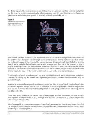 International Consultation on Urethral Strictures
114
the dorsal aspect of the surrounding tissues of the corpus spongiosum are thin, while ventrally they
are thick. As the urethra extends distally, it becomes more centrally placed in relation to the corpus
spongiosum, and through the glans it is relatively ventrally placed (Figure 2).
Anastomotic urethral reconstruction involves excision of the stricture and primary anastomosis of
the urethral ends. Surgeons cannot simply excise a stricture and restore continuity as when operat-
ing on bowel, because of the potential for causing chordee. It is a useful rule that the bulbar urethra
should not be mobilized distal to the penoscrotal junction, and therefore if the stricture is long it
may be necessary to carry out a substitution procedure. Similarly, it is very uncommon to be able to
perform an anastomotic urethral reconstruction in the penile urethra, except in the context of a very
limited traumatic injury of the penile urethra such as seen with penile fracture injuries.
Traditionally, only strictures less than 3 cm were considered suitable for an anastomotic procedure.
However, by freeing up the urethra and separating the corpora, another few centimetres may be
gained in length.
Morey et al. compared anastomotic procedures carried out for a stricture length ranging from 2.6 to
5.0 cm and reported success rates of 91%, as compared to a control group with stricture lengths less
than 2.5 cm. However, the series had only 11 patients in each group and the mean follow-up period
was 22 months (10).
Three large series looking at the success rates of anastomotic urethral reconstruction have recently
been reported, with Santucci et al. (11), Barbagli et al. (12), and Eltahawy et al. (13) reporting success
rates between 91% and 98%.
It is often possible to carry out an anastomotic urethral reconstruction for strictures longer than 2–3
cm using techniques (covered elsewhere) to straighten the natural curve of the bulbar urethra, thus
shortening its course (Figure 3).
Figure 2
Diagrammatic representation
of corporal thickness in the
bulbar and penile urethra
 