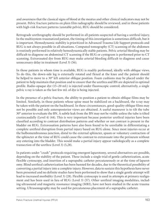 163
Pelvic Fracture Urethral Injuries (PFUI)
and awareness that the classical signs of blood at the meatus and other clinical indicators may not be
present. Pelvic fracture patterns on plain film radiography should be reviewed, and in those patients
with high-risk fracture patterns (unstable pelvis), RUG should be considered.
Retrograde urethrography should be performed in all patients suspected of having a urethral injury.
In the multisystem-traumatized patient, the timing of this investigation is sometimes difficult, but it
is important. Hemodynamic stability is prioritized in Advanced Trauma Life Support protocols and
RUG is not always possible in all situations. Computed tomography (CT) scanning of the abdomen
is routinely performed in relatively hemodynamically stable patients. Pelvic arterial bleeding may be
difficult to diagnose on abdominal CT scanning if the RUG or cystogram is performed prior to CT
scanning. Extravasated dye from RUG may make arterial bleeding difficult to diagnose and cause
unnecessary delay in treatment (Level 3) (56).
In those patients in whom time is available, RUG is readily performed, ideally with oblique views.
To do this, the down-side leg is externally rotated and flexed at the knee and the patient should
be helped to move to a 30° left anterior oblique position. Foam cushions may be placed under the
patient to help maintain that position and to ensure that the urethra and BN are depicted in optimal
profile. Radio-opaque dye (15–20 mL) is injected under fluoroscopic control; alternatively, a single
pelvic x-ray is taken as the last few mL of dye is being injected.
In the presence of a pelvic fracture, the ability to position a patient to obtain oblique films may be
limited. Similarly, in those patients whose spine must be stabilized on a backboard, the x-ray may
be taken with the patient on the backboard. In these circumstances, good-quality oblique films may
not be possible and only anteroposterior views are obtained. A useful maneuver is to tilt the tube
30° anterior to evaluate the BN. A subtle leak from the BN may not be visible unless the tube is tilted
craniocaudally (Level 4) (44). This is very important because posterior urethral injuries have been
classified according to contrast distribution patterns and whether or not contrast is present in the
bladder on RUG. Extravasation patterns have also been found to be unreliable in differentiating a
complete urethral disruption from partial injury based on RUG alone. Since most injuries occur at
the bulbomembranous junction, distal to the external sphincter, spasm or voluntary contraction of
the sphincter at the time of RUG could cause the contrast to extravasate into the perineum without
any entering into the bladder. This would make a partial injury appear radiologically as a complete
transection of the urethra (Level 3) (5,28).
In patients under “crash” protocols requiring emergent laparotomy, several alternatives are possible,
depending on the stability of the patient. These include a single trial of gentle catheterization, acute
flexible cystoscopy, and insertion of a suprapubic catheter percutaneously or at the time of laparot-
omy. Blind urethral catheterization has been banned for decades, due to the theoretical possibility of
converting a partial injury into a complete injury. However, data to sustain this hypothesis have never
been presented and no definite studies have been performed to show that a single gentle attempt will
lead to increased morbidity (Level 3) (28). Flexible cystoscopy is used in attempts at primary realign-
ment and has been used in lieu of RUG (Level 3) (57). Other urethral imaging modalities, includ-
ing ultrasound and magnetic resonance imaging (MRI), have not been studied in the acute trauma
setting. Ultrasonography may be used for percutaneous placement of a suprapubic catheter.
 