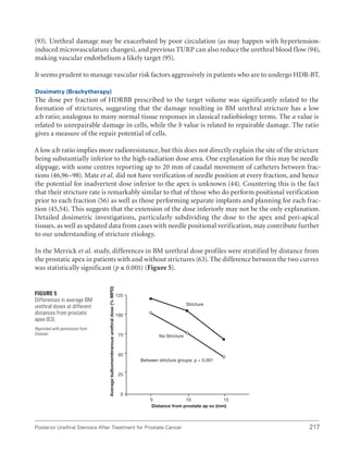 217
Posterior Urethral Stenosis After Treatment for Prostate Cancer
(93). Urethral damage may be exacerbated by poor circulation (as may happen with hypertension-
induced microvasculature changes), and previous TURP can also reduce the urethral blood flow (94),
making vascular endothelium a likely target (95).
It seems prudent to manage vascular risk factors aggressively in patients who are to undergo HDR-BT.
Dosimetry (Brachytherapy)
The dose per fraction of HDRBB prescribed to the target volume was significantly related to the
formation of strictures, suggesting that the damage resulting in BM urethral stricture has a low
a:b ratio; analogous to many normal tissue responses in classical radiobiology terms. The a value is
related to unrepairable damage in cells, while the b value is related to repairable damage. The ratio
gives a measure of the repair potential of cells.
A low a:b ratio implies more radioresistance, but this does not directly explain the site of the stricture
being substantially inferior to the high-radiation dose area. One explanation for this may be needle
slippage, with some centres reporting up to 20 mm of caudal movement of catheters between frac-
tions (46,96–98). Mate et al. did not have verification of needle position at every fraction, and hence
the potential for inadvertent dose inferior to the apex is unknown (44). Countering this is the fact
that their stricture rate is remarkably similar to that of those who do perform positional verification
prior to each fraction (56) as well as those performing separate implants and planning for each frac-
tion (45,54). This suggests that the extension of the dose inferiorly may not be the only explanation.
Detailed dosimetric investigations, particularly subdividing the dose to the apex and peri-apical
tissues, as well as updated data from cases with needle positional verification, may contribute further
to our understanding of stricture etiology.
In the Merrick et al. study, differences in BM urethral dose profiles were stratified by distance from
the prostatic apex in patients with and without strictures (63). The difference between the two curves
was statistically significant (p ≤ 0.001) (Figure 5).
Figure 5
Differences in average BM
urethral doses at different
distances from prostatic
apex (63).
Reprinted with permission from
Elsevier.
Stricture
No Stricture
Distance from prostate ap ex (mm)
Between stricture groups: p  0.001
Average
bulbomembranous
urethral
dose
(%
MPD)
5 10 15
125
100
75
50
25
0
 
