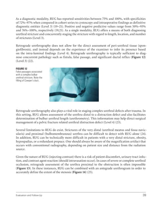 Evaluation and Follow-Up 39
As a diagnostic modality, RUG has reported sensitivities between 75% and 100%, with specificities
of 72%–97% when compared in cohort series to cystoscopy and intraoperative findings as definitive
diagnostic entities (Level 3) (19–21). Positive and negative predictive values range from 50%–93%
and 76%–100%, respectively (19,21). As a single modality, RUG offers a means of both diagnosing
urethral stricture and concurrently staging the stricture with regard to length, location, and number
of strictures (Level 3).
Retrograde urethrography does not allow for the direct assessment of peri-urethral tissue (spon-
giofibrosis), and instead depends on the experience of the examiner to infer its presence based
on the intra-luminal findings (Level 4). Retrograde urethrography is typically sufficient to diag-
nose concurrent pathology such as fistula, false passage, and significant ductal reflux (Figure 12)
(Level 3) (22).
Retrograde urethrography also plays a vital role in staging complex urethral defects after trauma. In
this setting, RUG allows assessment of the urethra distal to a distraction defect and also facilitates
determination of bulbar urethral length (urethrometry). This information may help direct surgical
management of a pelvic fracture related urethral distraction defect (Level 4) (23).
Several limitations to RUG do exist. Strictures of the very distal (urethral meatus and fossa navic-
ularis) and proximal (bulbomembranous) urethra can be difficult to detect with RUG alone (24).
In addition, RUG can be technically more difficult in patients with a very distal stricture, obesity,
hypospadias, or a redundant prepuce. One should always be aware of the magnification artifact that
occurs with conventional radiography, depending on patient size and distance from the radiation
source.
Given the nature of RUG (injecting contrast) there is a risk of patient discomfort, urinary tract infec-
tion, and contrast agent reaction (should intravasation occur). In cases of severe or complete urethral
occlusion, retrograde assessment of the urethra proximal to the obstruction is often impossible
(Figure 13). In these instances, RUG can be combined with an antegrade urethrogram in order to
accurately define the extent of the stenosis (Figure 14) (25).
Figure 12
False passages associated
with a complex bulbar
urethral stricture. Note the
filling of Cowper’s duct.
 
