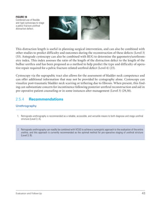 Evaluation and Follow-Up 43
Figure 18
Combined use of flexible
and rigid cystoscopy to stage
a pelvic fracture urethral
distraction defect.
This distraction length is useful in planning surgical intervention, and can also be combined with
other studies to predict difficulty and outcomes during the reconstruction of these defects (Level 3)
(33). Antegrade cystoscopy can also be combined with RUG to determine the gapometry/urethrom-
etry index. This index assesses the ratio of the length of the distraction defect to the length of the
bulbar urethra and has been proposed as a method to help predict the type and difficulty of opera-
tive repair required for a pelvic fracture-related urethral defect (Level 4) (23).
Cystoscopy via the suprapubic tract also allows for the assessment of bladder neck competence and
can offer additional information that may not be provided by cystography alone. Cystoscopy can
visualize post-traumatic bladder neck scarring or tethering due to fibrosis. When present, this find-
ing can substantiate concern for incontinence following posterior urethral reconstruction and aid in
pre-operative patient counseling or in some instances alter management (Level 3) (29,30).
2.5.4 Recommendations
Urethrography
1. Retrograde urethrography is recommended as a reliable, accessible, and versatile means to both diagnose and stage urethral
stricture (Level 3; A).
2. Retrograde urethrography can readily be combined with VCUG to achieve a synergistic approach to the evaluation of the entire
urethra, and this approach is currently recommended as the optimal method for pre-operative staging of urethral stricture
(Level 3; B).
 
