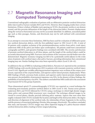 International Consultation on Urethral Strictures
46
2.7 
Magnetic Resonance Imaging and
Computed Tomography
Conventional radiographic evaluation of patients with an obliterative posterior urethral distraction
defect due to pelvic fracture includes RUG and VCUG. However, these imaging studies have certain
limitations. If there is failure of bladder neck opening on VCUG, the prostatic urethra is not demon-
strated, and this prevents delineation of the length of the distraction defect. Prostatic displacement
along the vertical or horizontal axis may not be accurately identified. In addition, associated pathol-
ogy such as false passages, fistulas, and diverticula may not be well outlined with conventional
imaging.
In an attempt to overcome these limitations, MRI has been used for evaluation of obliterative poste-
rior urethral distraction defects, with the first published report in 1992 (Level 3) (39). A total of
18 patients with complete occlusion of the prostatomembranous urethra from pelvic crush injury
underwent MRI of the pelvis just before open urethroplasty. All patients underwent conventional
cystography and RUG, and operative findings were correlated with MRI. The severity and direction
of prostato-urethral dislocation in all three planes, and the length of the urethral defect could be
accurately determined using MRI. Fractures and avulsions of the cavernous erectile bodies were also
demonstrated. Magnetic resonance imaging was felt to be a potentially useful adjunct in the evalu-
ation of patients with urethral injury after pelvic fracture, providing information that conventional
imaging may not. Similar findings have since been reported by others (Level 3) (40–42).
In addition to the use of MRI in evaluating urethral defects, Narumi et al. reported on the correlation
of MRI findings with erectile dysfunction (ED) in patients with traumatic posterior urethral injury
(Level 3) (43). Significant variables affecting permanent impotence were avulsion of the corpus caver-
nosum, separation of the corporal bodies, and superior and/or lateral prostatic displacement. When
MRI findings of both cavernous body avulsion and superior and/or lateral prostatic displacement
were present, the probability of permanent impotence was 95%. In the absence of these findings, the
probability of normal potency was 83%. The authors concluded that MRI could aid in the assessment
of permanent ED in this group of patients.
Three-dimensional spiral CT cystourethrography (CTCUG) was reported as a novel technique for
evaluating post-traumatic posterior urethral defects in 2003 (Level 3) (44). Twenty-seven patients
underwent RUG and VCUG followed by CTCUG using a technique in which high-density images
(bony pelvic and contrast-filled structures) were visualized. The technique allowed images to be
viewed in several planes, thereby precisely defining pelvic anatomy. Aspects that were more thor-
oughly evaluated with CTCUG included the location and length of the distraction defect, the degree
and direction of alignment of the urethral ends, the relationship of bony fragments to the urethra,
and the presence of associated pathology (fistulas, false passages, diverticula). The authors concluded
that static and dynamic CTCUG images may allow improved staging of a pelvic-fracture–related
urethral distraction defect, leading to better surgical planning.
 