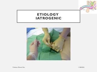 11/08/2025
Professor Bhavani Rao
ETIOLOGY
IATROGENIC
 