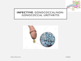 11/08/2025
Professor Bhavani Rao
INFECTIVE: GONOCOCCAL/NON-
GONOCOCCAL URETHRITIS
 
