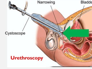11/08/2025
Professor Bhavani Rao
Urethroscopy
 