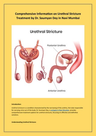 Comprehensive Information on Urethral Stricture
Treatment by Dr. Soumyan Dey in Navi Mumbai
Introduction:
Urethral stricture is a condition characterized by the narrowing of the urethra, the tube responsible
for carrying urine out of the body. Dr. Soumyan Dey, a urologist in Navi Mumbai, provides
comprehensive treatment options for urethral strictures, focusing on effective and definitive
solutions.
Understanding Urethral Stricture:
 