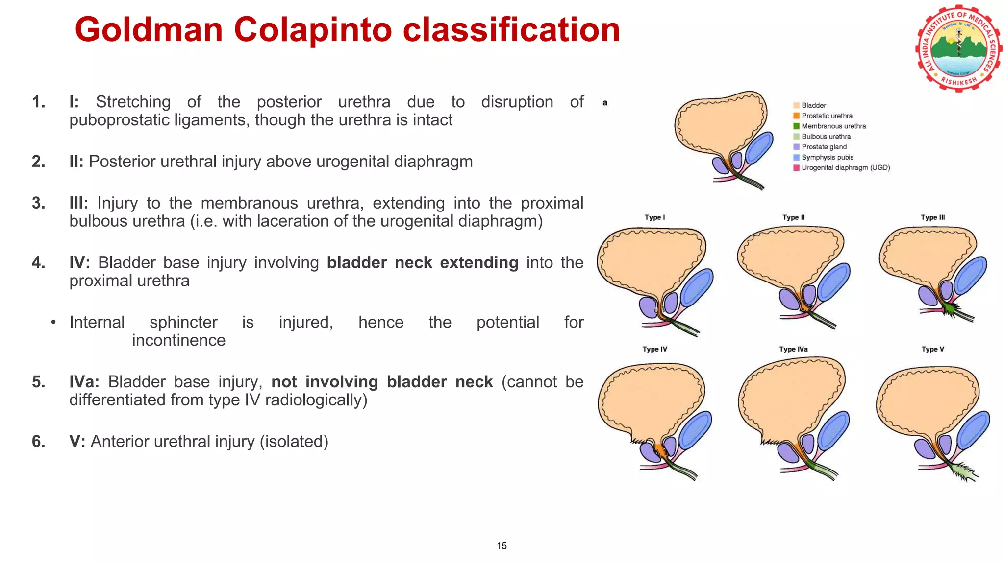 1. I: Stretching of the posterior urethra due to disruption of
puboprostatic ligaments, though the urethra is intact
2. II: Posterior urethral injury above urogenital diaphragm
3. III: Injury to the membranous urethra, extending into the proximal
bulbous urethra (i.e. with laceration of the urogenital diaphragm)
4. IV: Bladder base injury involving bladder neck extending into the
proximal urethra
• Internal sphincter is injured, hence the potential for
incontinence
5. IVa: Bladder base injury, not involving bladder neck (cannot be
differentiated from type IV radiologically)
6. V: Anterior urethral injury (isolated)
Goldman Colapinto classification
15
 